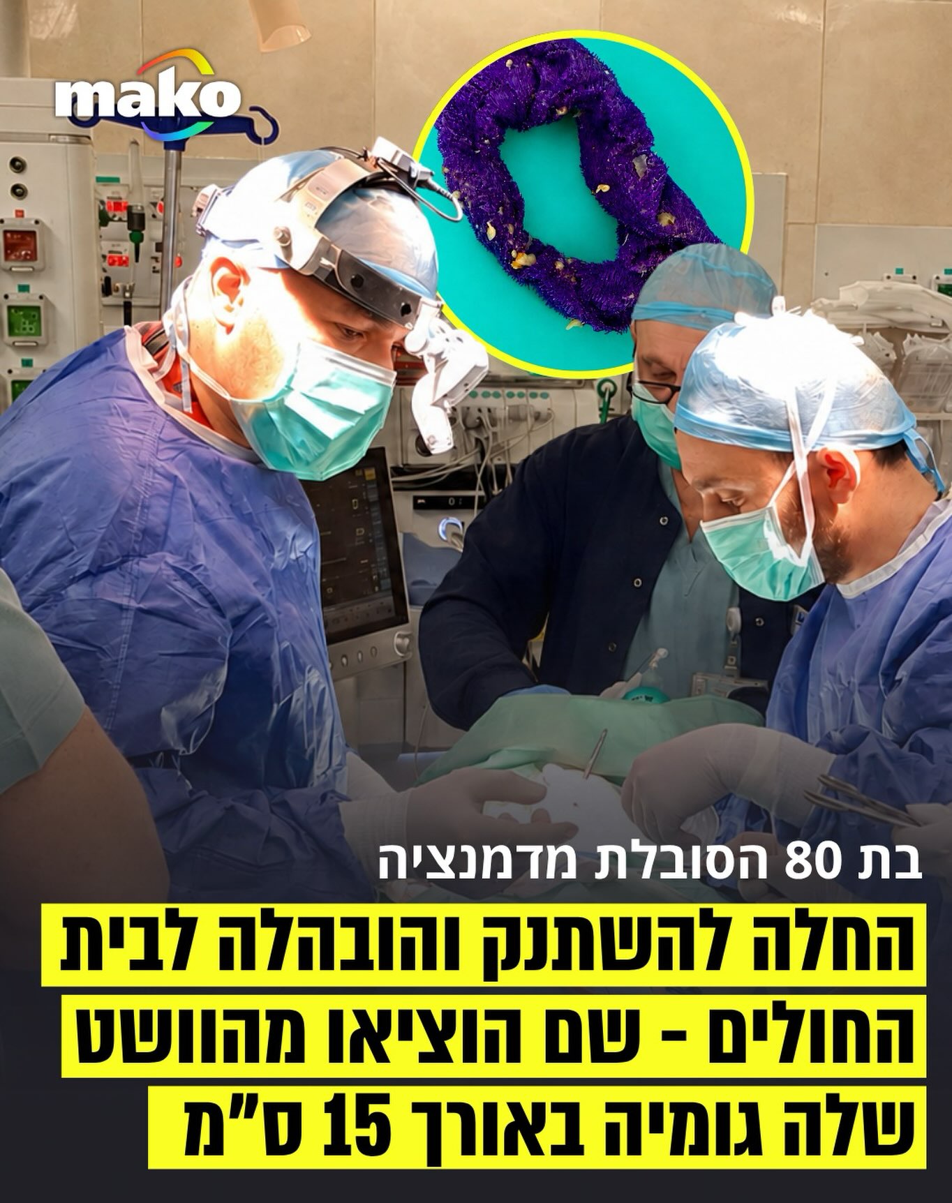 מטופלת כבת 80 ניצלה לאחר שרופאים במרכז הרפואי זיו בצפת שלפו...