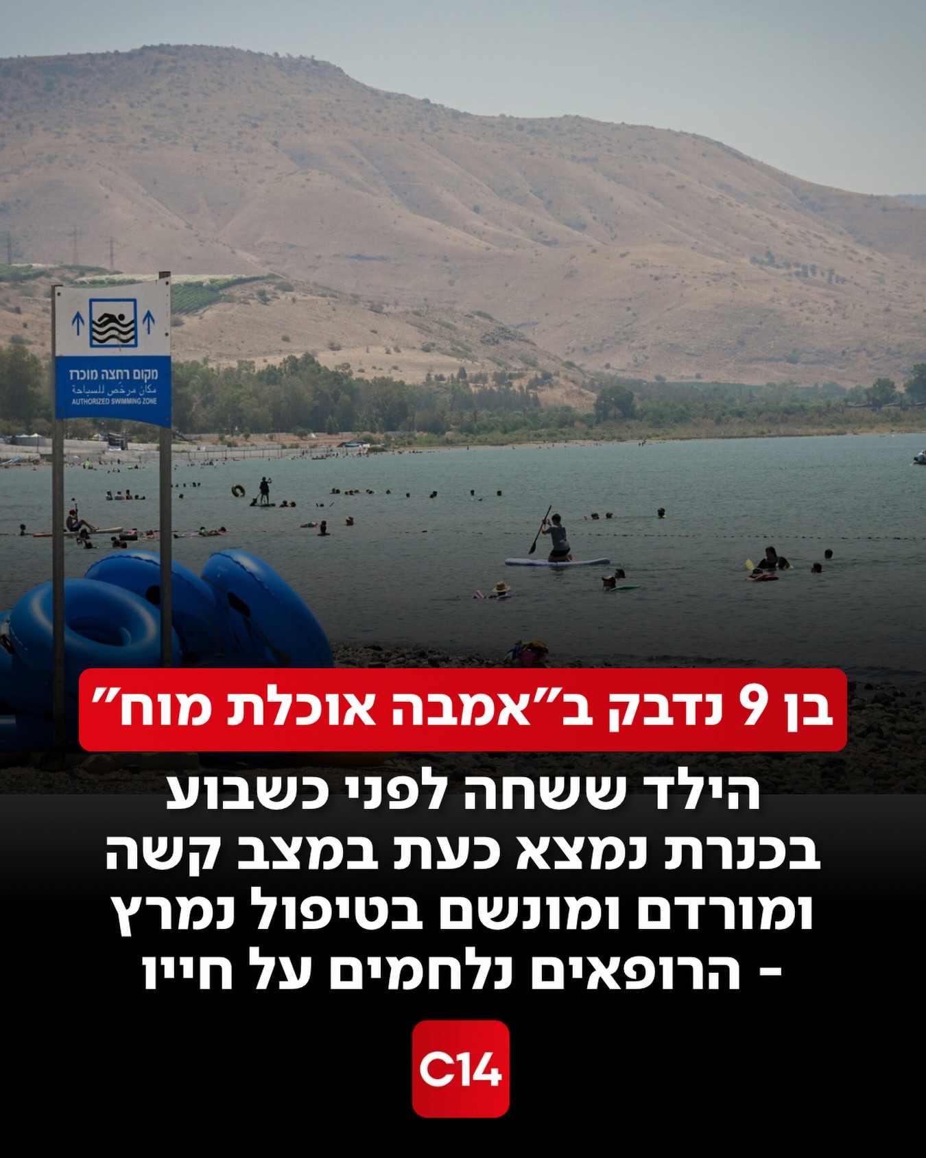 ילד כבן תשע מאושפז במצב קשה בבית החולים רמב״ם, לאחר שחלה בדלקת...