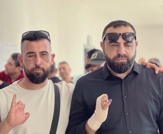 ביפ 📟 💥 ביפ ביפ. תכף נשוב 🤣🤣🤣...