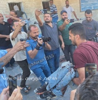 אף אחד לא קם לעזור, ישר שולפים מצלמה...