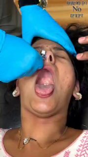 ניפח לה את הבלון מהאף ופיצה לה את זה כשיצא מהפה 😳
...