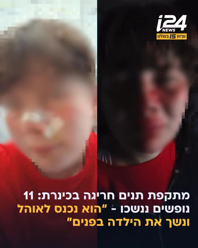 אירוע חריג ומבהיל התרחש באזור הכינרת כאשר מספר נופשים ננשכו...