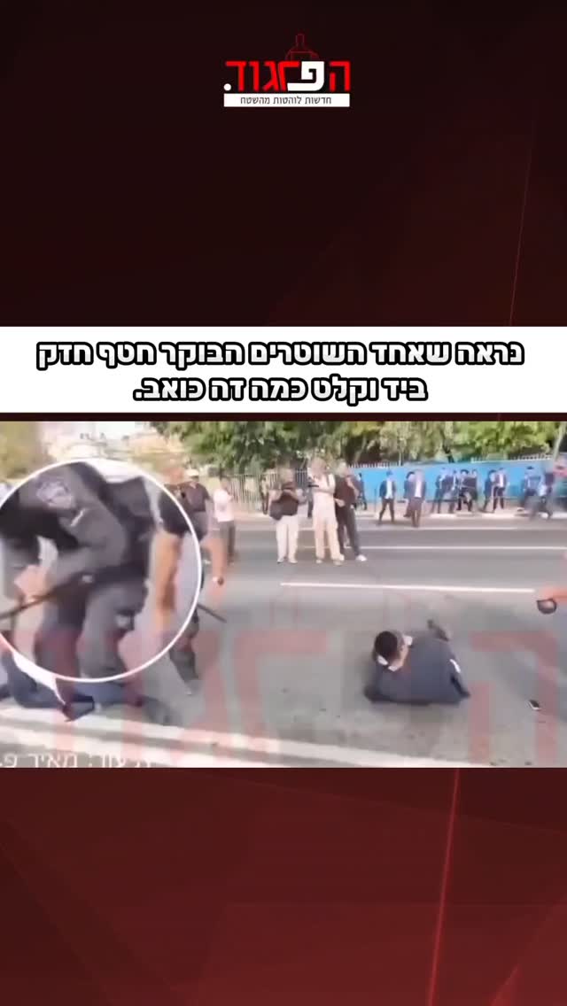 נראה שאחד השוטרים הבוקר חטף חזק ביד וקלט כמה זה כואב....